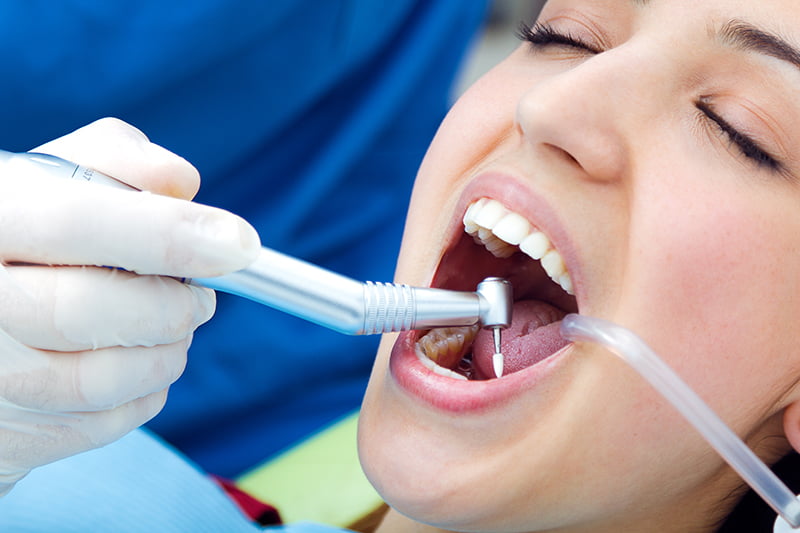 chequeo dental Albacete