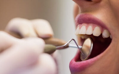 Descubre los tratamientos que ofrecemos en Clínica Dental Parque
