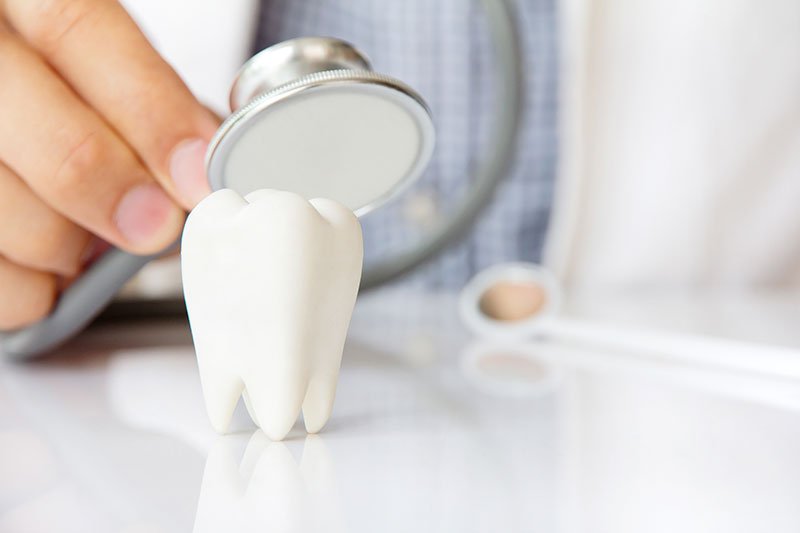 ventajas limpieza dental