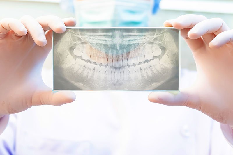 radiografía llevando brackets