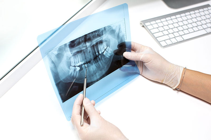 Radiografía llevando ortodoncia | Clínica Dental Parque