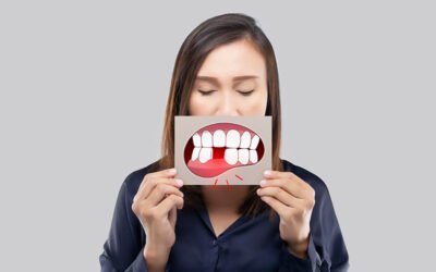 ¿Qué es una fisura dental?