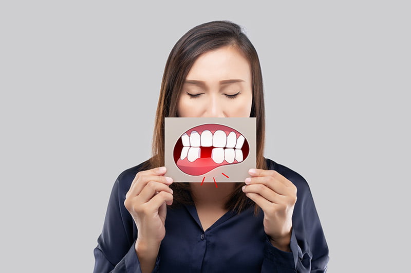 ¿Qué es una fisura dental?