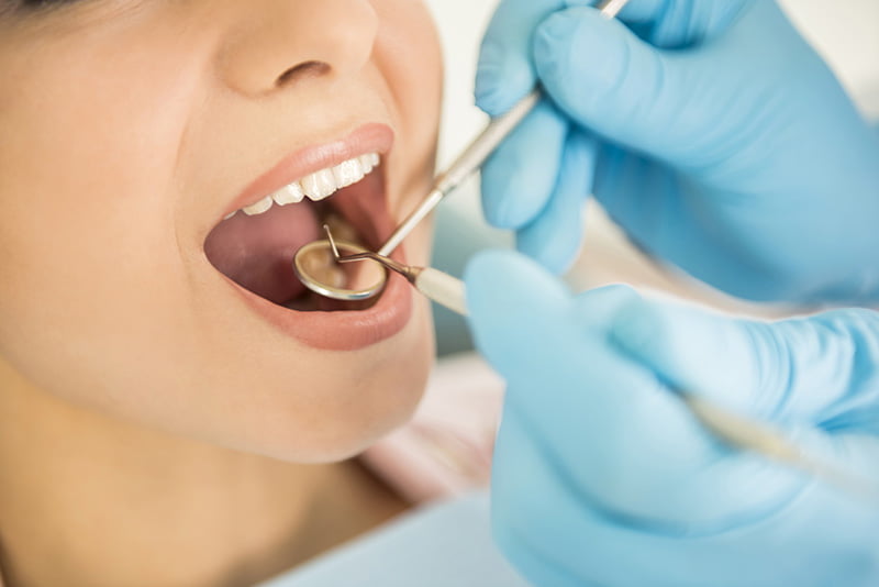 raspado dental albacete