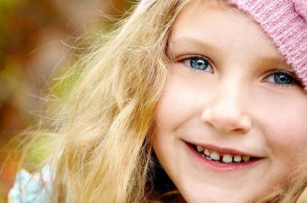 Diastema dental: el problema de los dientes separados