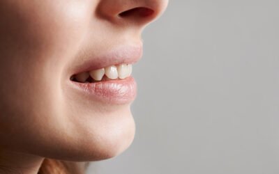 Desgaste de los dientes: todo lo que debes saber