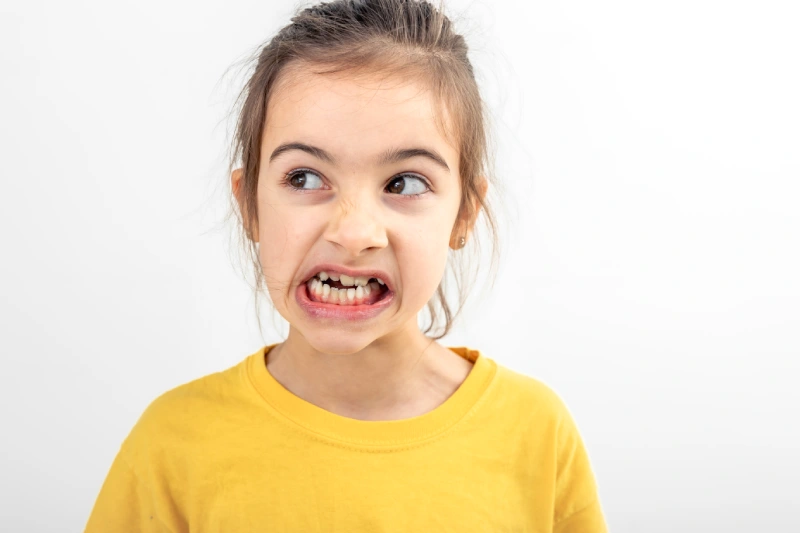 dientes mal colocados