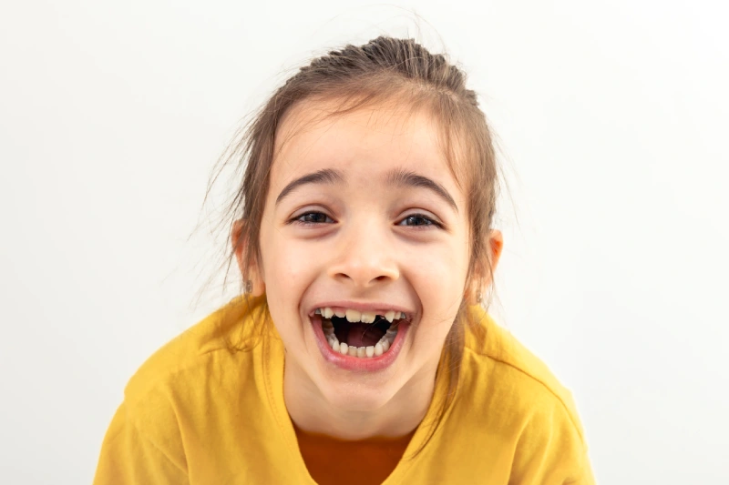 niños con los dientes torcidos